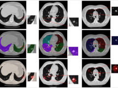 Training-CADe-Algorithms-NEW