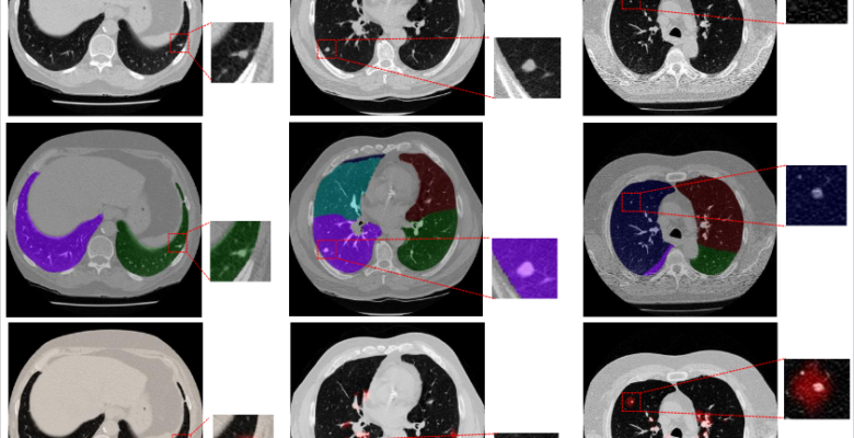 Training-CADe-Algorithms-NEW